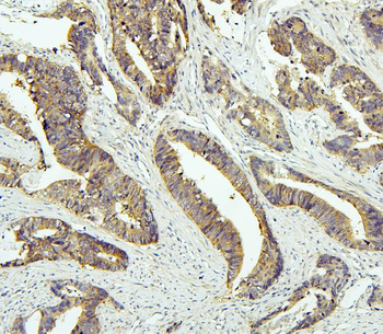Anti-Tafazzin/TAZ Antibody