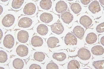 Anti-Tafazzin/TAZ Antibody