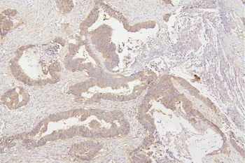 Anti-Tafazzin/TAZ Antibody