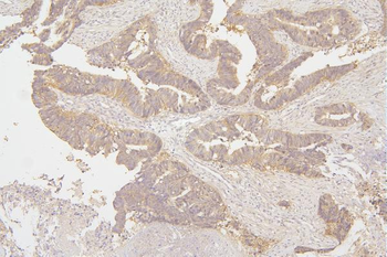 Anti-Tafazzin/TAZ Antibody