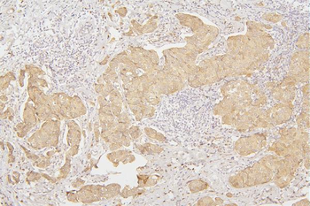 Anti-Tafazzin/TAZ Antibody