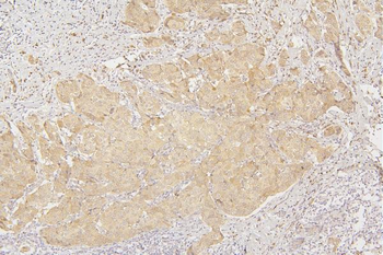 Anti-Tafazzin/TAZ Antibody