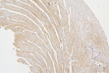 Anti-Tafazzin/TAZ Antibody