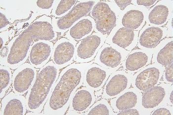 Anti-Tafazzin/TAZ Antibody