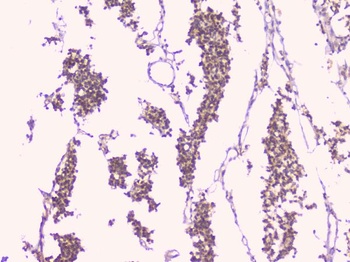 Osteoprotegerin/TNFRSF11B Antibody