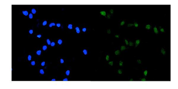 Topoisomerase II alpha/TOP2A Antibody