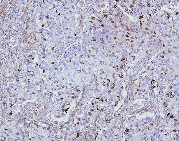 Topoisomerase II alpha/TOP2A Antibody