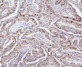 Topoisomerase II alpha/TOP2A Antibody