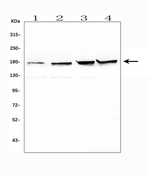 Topoisomerase II alpha/TOP2A Antibody