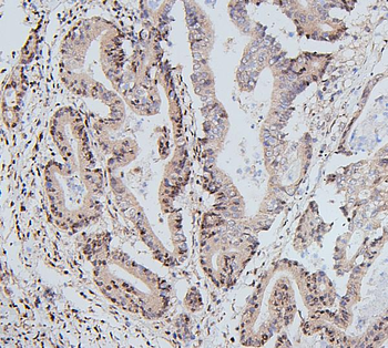 Anti-UBE2I/UBC9 Antibody