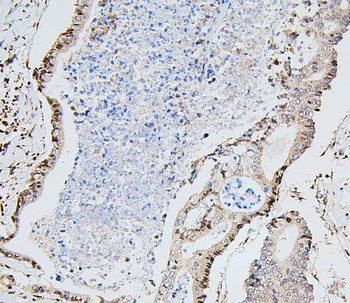 Anti-UBE2I/UBC9 Antibody