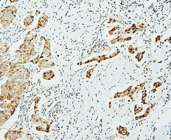 Anti-UBE2I/UBC9 Antibody