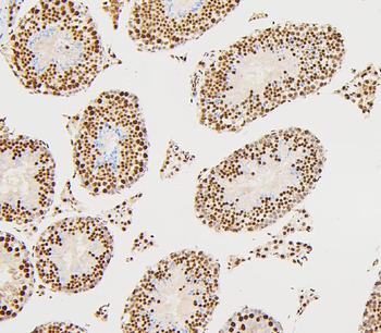 Anti-UBE2I/UBC9 Antibody