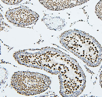 Anti-UBE2I/UBC9 Antibody