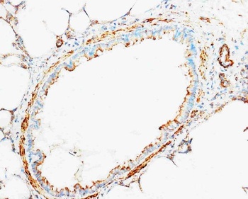 Cytochrome C/CYCS Antibody