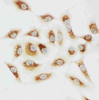 Cytochrome C/CYCS Antibody