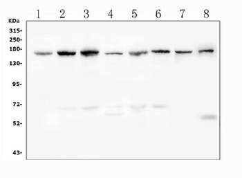 Desmoglein 2/DSG2 Antibody