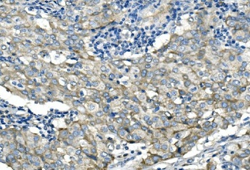 Anti-Desmoglein 2/DSG2 Antibody