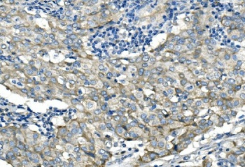 Desmoglein 2/DSG2 Antibody