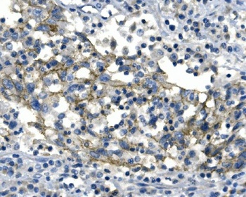 Desmoglein 2/DSG2 Antibody