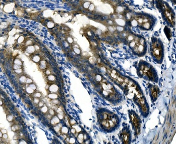 Anti-Desmoglein 2/DSG2 Antibody