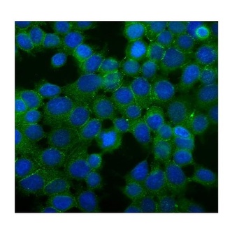 Desmoglein 2/DSG2 Antibody