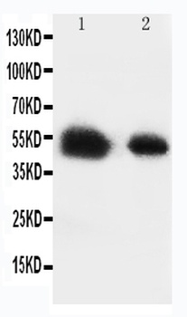 Glucose Transporter 8/SLC2A8 Antibody