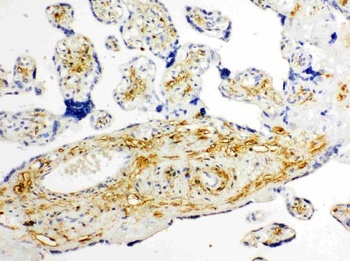 Glucose Transporter 8/SLC2A8 Antibody