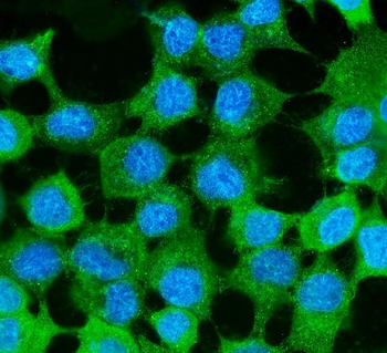 Anti-MVP Antibody (monoclonal, 8B12)