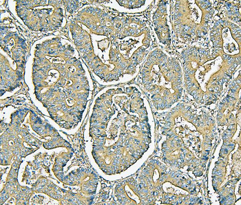Anti-MVP Antibody (monoclonal, 8B12)