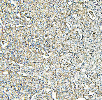 Anti-MVP Antibody (monoclonal, 8B12)