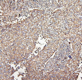 Anti-MVP Antibody (monoclonal, 8B12)