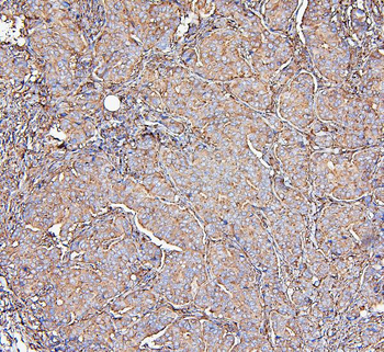 Anti-MVP Antibody (monoclonal, 8B12)