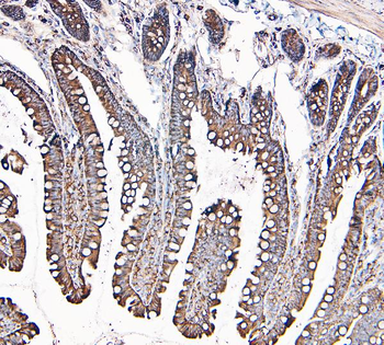 Anti-MVP Antibody (monoclonal, 8B12)