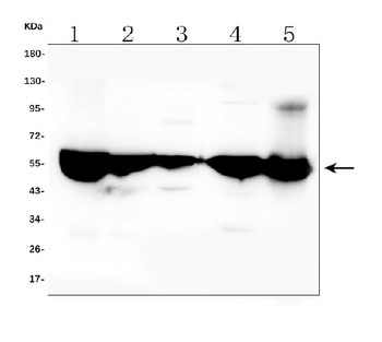 ALDH2 Antibody (monoclonal, 5G7)