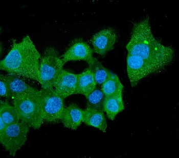 Anti-ALDH2 Antibody (monoclonal, 5G7)