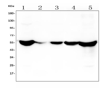 Anti-ALDH2 Antibody (monoclonal, 5G7)