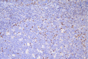 CD79a Mouse Monoclonal Antibody