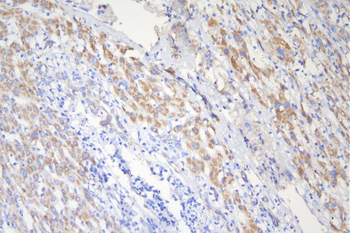 Anti-Tuberin TSC2 Antibody (monoclonal, 6I3)