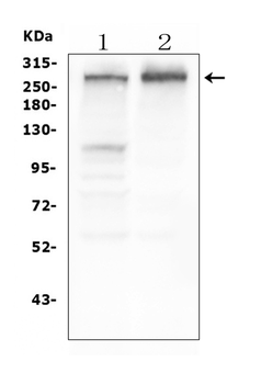 Anti-Tuberin TSC2 Antibody (monoclonal, 6I3)