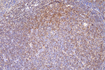 Anti-DCK Antibody (monoclonal, 3G10)