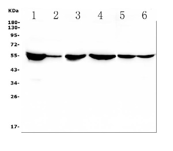 Beta Tubulin TUBB Antibody (monoclonal, 2E11)