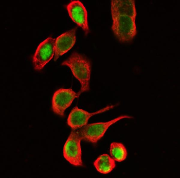Anti-Beta Tubulin TUBB Antibody (monoclonal, 2E11)