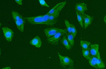 Anti-Beta Tubulin TUBB Antibody (monoclonal, 2E11)