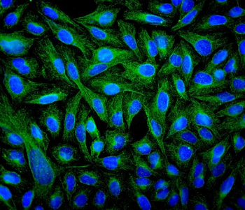 Anti-Beta Tubulin TUBB Antibody (monoclonal, 2E11)