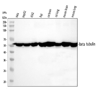 Anti-Beta Tubulin TUBB Antibody (monoclonal, 2E11)