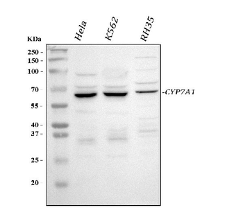 Anti-CYP7A1 Antibody