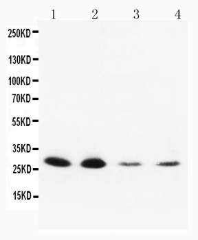 Neurotrophin 3/NTF3 Antibody