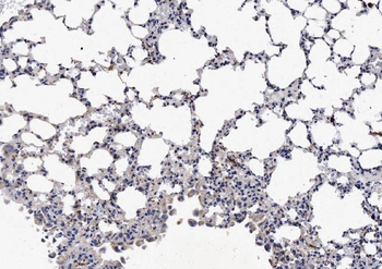 Anti-NCR1 Antibody