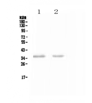 Anti-NCR1 Antibody